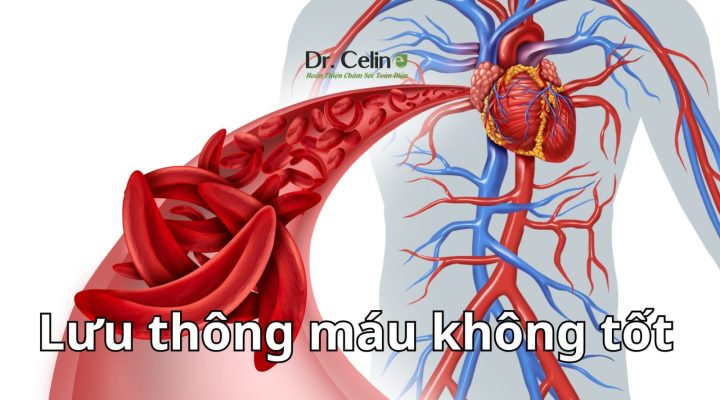 Lưu thông máu không tốt