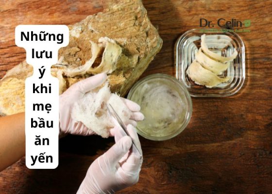 Những lưu ý khi mẹ bầu ăn yến