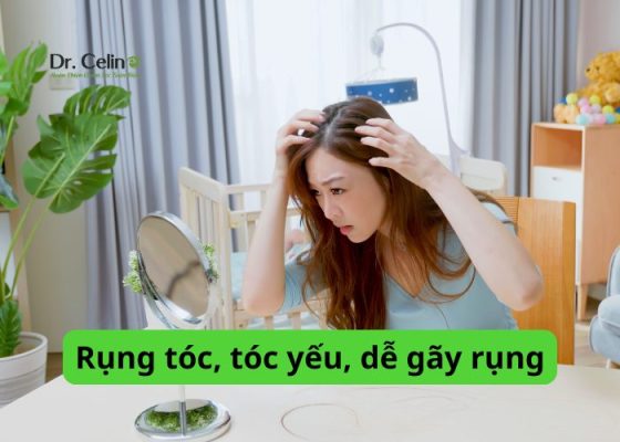 Rụng tóc, tóc yếu, dễ gãy rụng