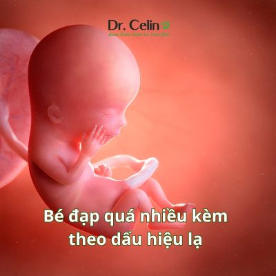 Bé đạp quá nhiều kèm theo dấu hiệu lạ